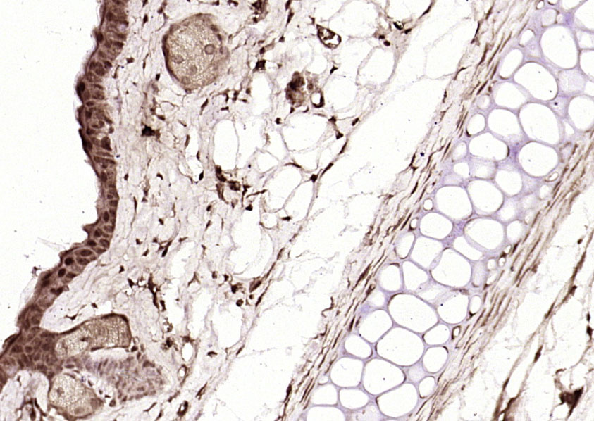 Paraformaldehyde-fixed, paraffin embedded Mouse skin; Antigen retrieval by boiling in sodium citrate buffer (pH6.0) for 15min; Block endogenous peroxidase by 3% hydrogen peroxide for 20 minutes; Blocking buffer (normal goat serum) at 37°C for 30min; Antibody incubation with MEK1+MEK2(Ser222/Ser226) Polyclonal Antibody, Unconjugated (bs-5414R) at 1:200 overnight at 4°C, DAB staining.