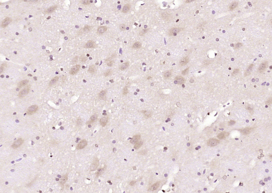 Paraformaldehyde-fixed, paraffin embedded Rat brain; Antigen retrieval by boiling in sodium citrate buffer (pH6.0) for 15min; Block endogenous peroxidase by 3% hydrogen peroxide for 20 minutes; Blocking buffer (normal goat serum) at 37°C for 30min; Antibody incubation with RASGRF1 (Ser929) Polyclonal Antibody, Unconjugated (bs-5683R) at 1:200 overnight at 4°C, DAB staining.