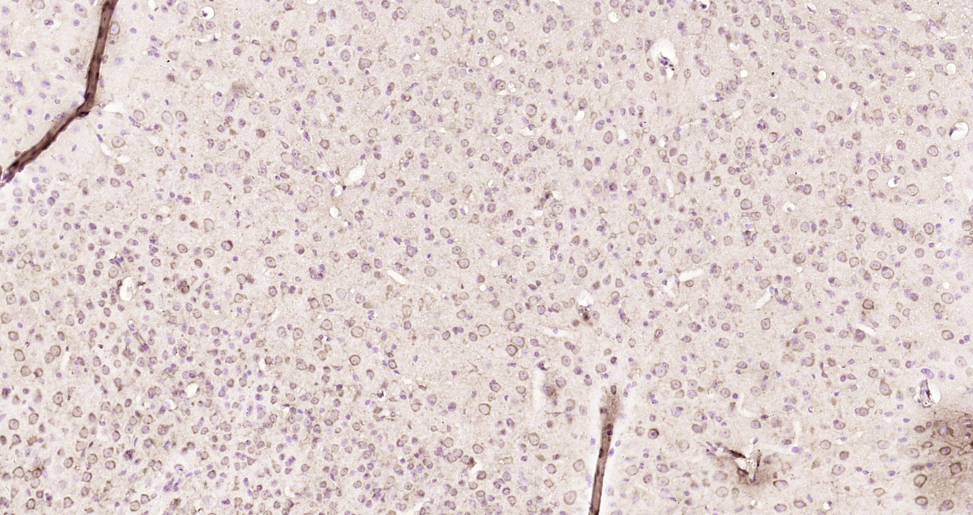 Paraformaldehyde-fixed, paraffin embedded Mouse brain; Antigen retrieval by boiling in sodium citrate buffer (pH6.0) for 15min; Block endogenous peroxidase by 3% hydrogen peroxide for 20 minutes; Blocking buffer (normal goat serum) at 37°C for 30min; Antibody incubation with TP53I13 Polyclonal Antibody, Unconjugated (bs-6145R) at 1:200 overnight at 4°C, DAB staining.