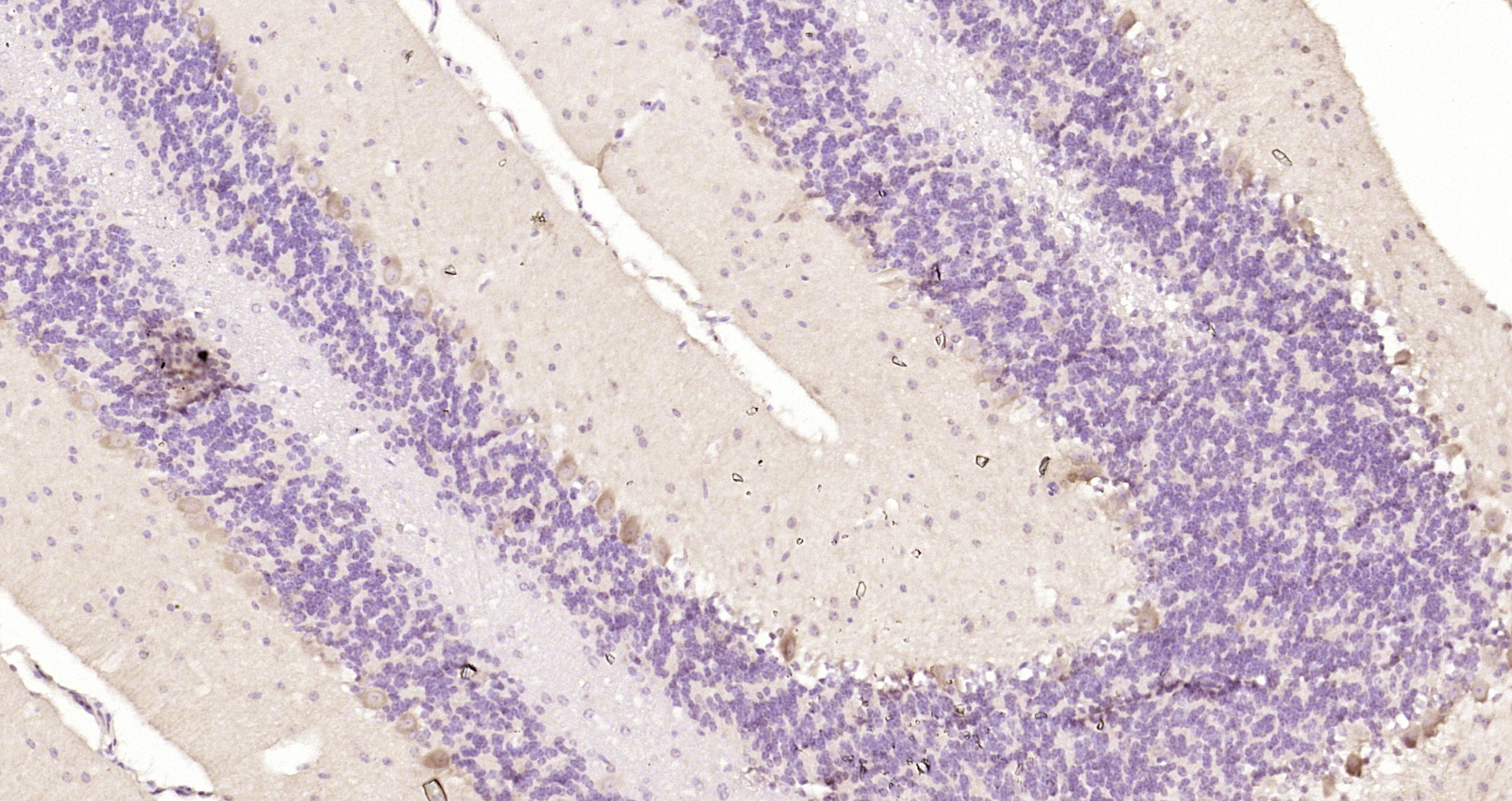 Paraformaldehyde-fixed, paraffin embedded Mouse cerebellum; Antigen retrieval by boiling in sodium citrate buffer (pH6.0) for 15min; Block endogenous peroxidase by 3% hydrogen peroxide for 20 minutes; Blocking buffer (normal goat serum) at 37°C for 30min; Antibody incubation with _x000D_ Ankyrin erythroid Polyclonal Antibody, Unconjugated (bs-7594R) at 1:200 overnight at 4°C, DAB staining.