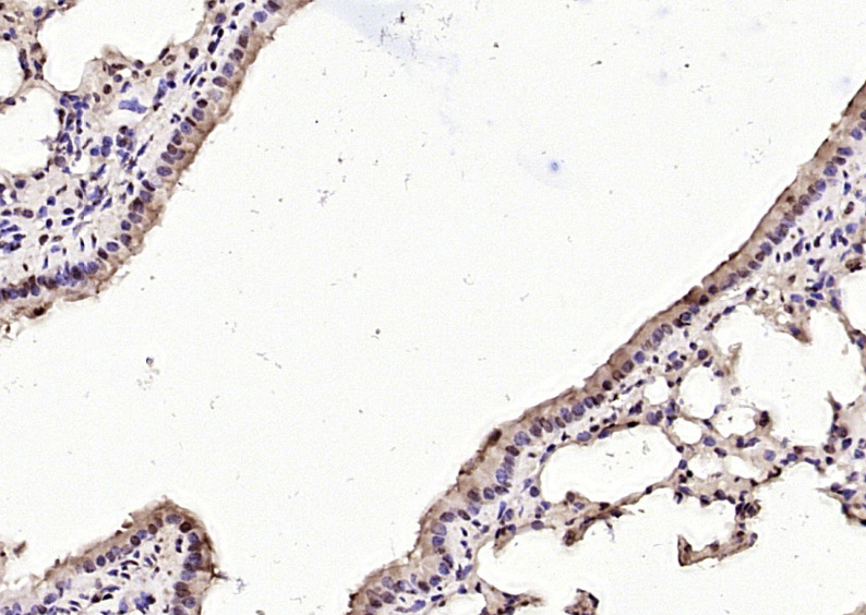 Paraformaldehyde-fixed, paraffin embedded Mouse lung; Antigen retrieval by boiling in sodium citrate buffer (pH6.0) for 15min; Block endogenous peroxidase by 3% hydrogen peroxide for 20 minutes; Blocking buffer (normal goat serum) at 37°C for 30min; Antibody incubation with NFATC4 (Ser168 + Ser170) Polyclonal Antibody, Unconjugated (bs-8535R) at 1:200 overnight at 4°C, DAB staining.