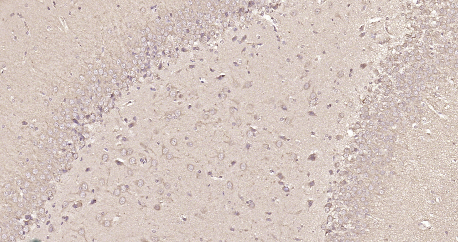 Paraformaldehyde-fixed, paraffin embedded Rat brain; Antigen retrieval by boiling in sodium citrate buffer (pH6.0) for 15min; Block endogenous peroxidase by 3% hydrogen peroxide for 20 minutes; Blocking buffer (normal goat serum) at 37°C for 30min; Antibody incubation with C9orf86 Polyclonal Antibody, Unconjugated (bs-9545R) at 1:200 overnight at 4°C, DAB staining.
