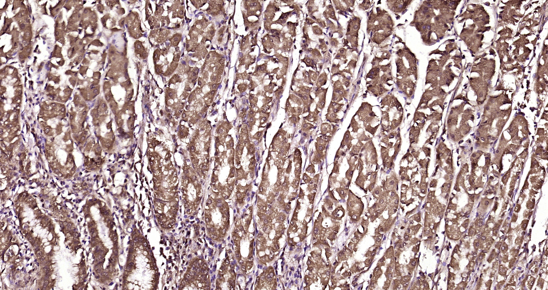 Paraformaldehyde-fixed, paraffin embedded Human stomach; Antigen retrieval by boiling in sodium citrate buffer (pH6.0) for 15min; Block endogenous peroxidase by 3% hydrogen peroxide for 20 minutes; Blocking buffer (normal goat serum) at 37°C for 30min; Antibody incubation with Cytohesin 2 Polyclonal Antibody, Unconjugated (bs-12922R) at 1:200 overnight at 4°C, DAB staining.
