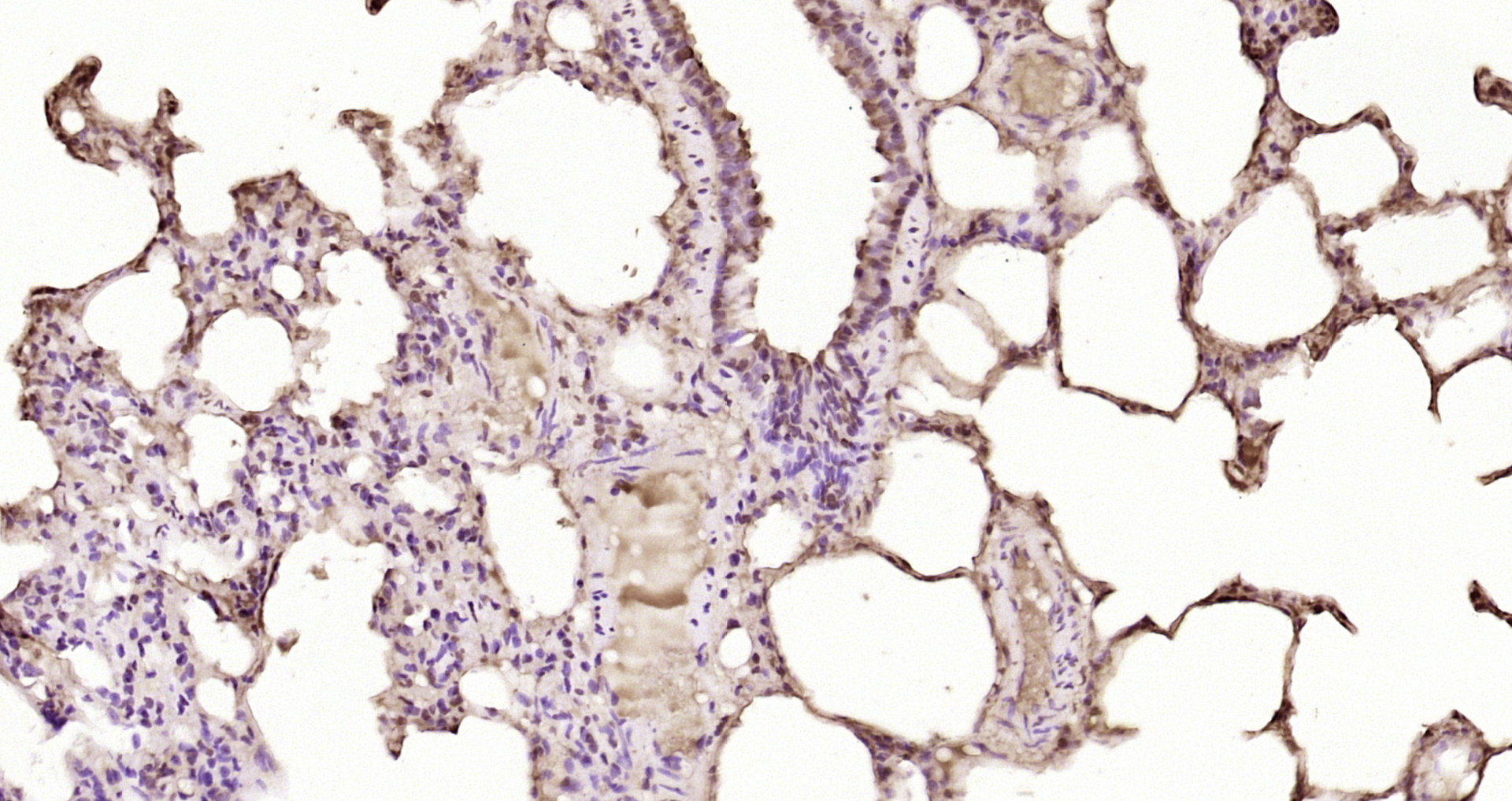 Paraformaldehyde-fixed, paraffin embedded Rat lung; Antigen retrieval by boiling in sodium citrate buffer (pH6.0) for 15min; Block endogenous peroxidase by 3% hydrogen peroxide for 20 minutes; Blocking buffer (normal goat serum) at 37°C for 30min; Antibody incubation with EYA2 Polyclonal Antibody, Unconjugated (bs-13125R) at 1:200 overnight at 4°C, DAB staining.