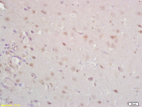 Formalin-fixed and paraffin embedded rat brain labeled with Anti Tomoregulin-1 Polyclonal Antibody, Unconjugated (bs-6117R) at 1:200 followed by conjugation to the secondary antibody and DAB staining