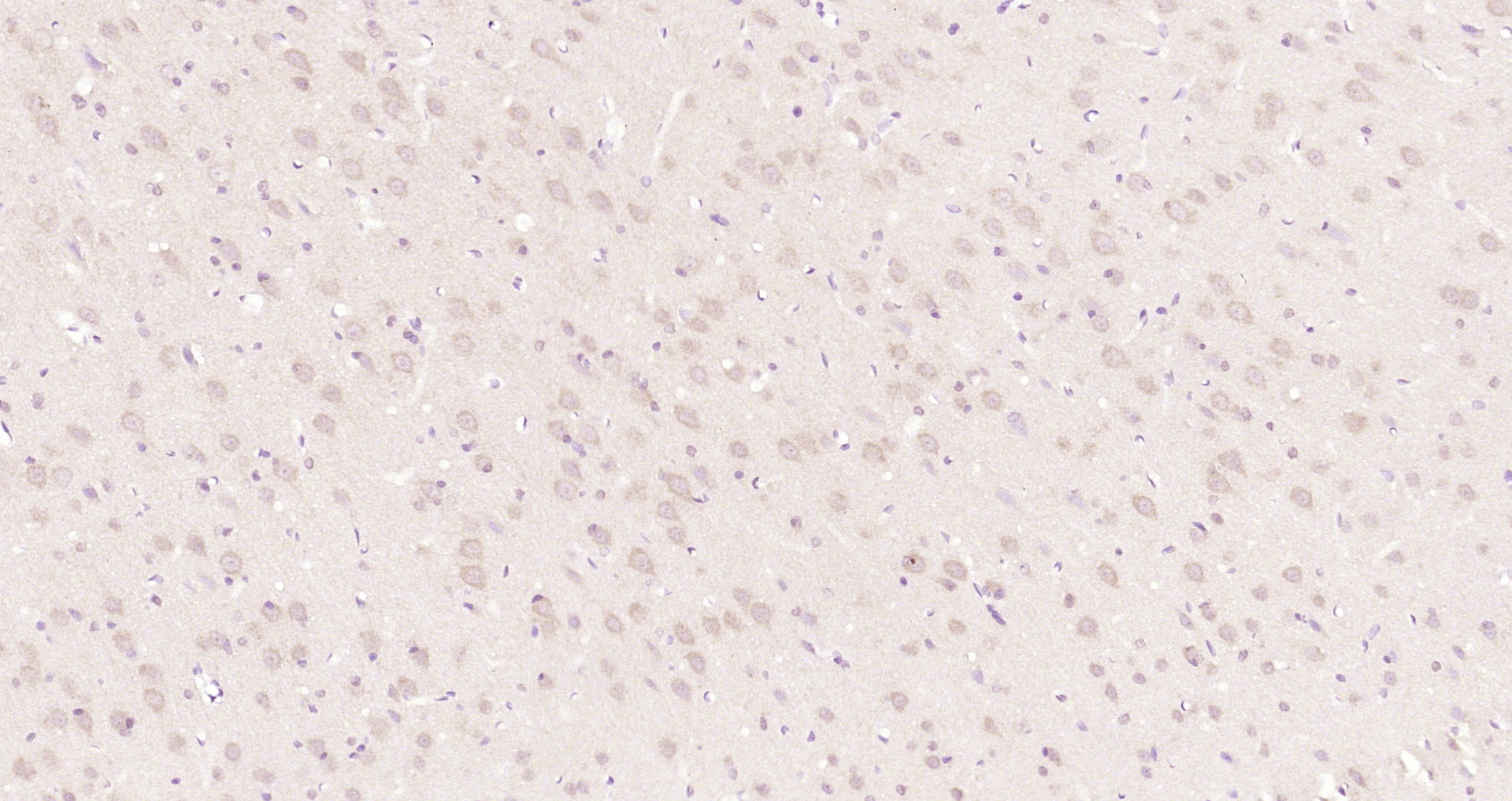 Paraformaldehyde-fixed, paraffin embedded Rat brain; Antigen retrieval by boiling in sodium citrate buffer (pH6.0) for 15min; Block endogenous peroxidase by 3% hydrogen peroxide for 20 minutes; Blocking buffer (normal goat serum) at 37°C for 30min; Antibody incubation with CTNND2/delta 2 Catenin Polyclonal Antibody, Unconjugated (bs-22251R) at 1:200 overnight at 4°C, DAB staining. Paraformaldehyde-fixed, paraffin embedded Rat brain; Antigen retrieval by boiling in sodium citrate buffer (pH6.0) for 15min; Block endogenous peroxidase by 3% hydrogen peroxide for 20 minutes; Blocking buffer (normal goat serum) at 37°C for 30min; Antibody incubation with CTNND2/delta 2 Catenin Polyclonal Antibody, Unconjugated (bs-22251R) at 1:200 overnight at 4°C, DAB staining.
