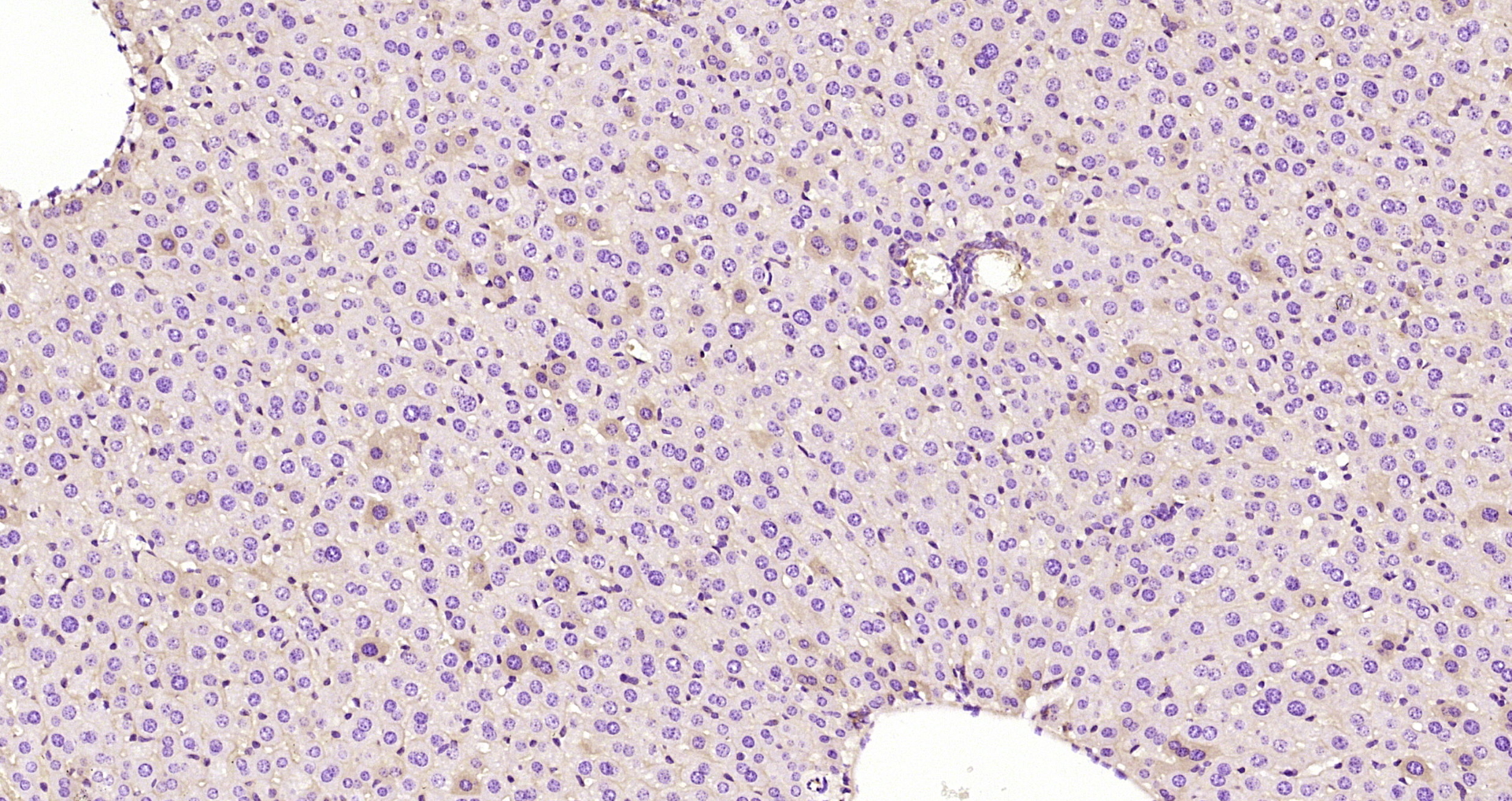 Paraformaldehyde-fixed, paraffin embedded Mouse liver; Antigen retrieval by boiling in sodium citrate buffer (pH6.0) for 15min; Block endogenous peroxidase by 3% hydrogen peroxide for 20 minutes; Blocking buffer (normal goat serum) at 37°C for 30min; Antibody incubation with CK18 Monoclonal Antibody, Unconjugated (bsm-33103M) at 1:400 overnight at 4°C, DAB staining.