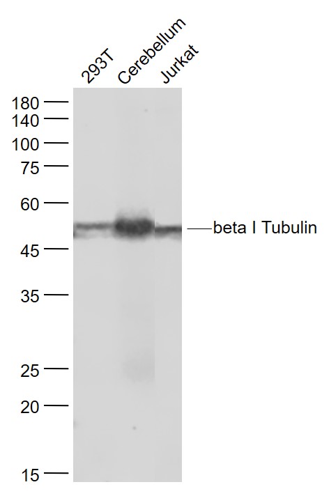 Lane 1：Human 293T cell lysates; Lane 2: Mouse Cerebellum lysates; Lane 3:Human Jurkat cell lysates probed with beta 1 Tubulin Monoclonal Antibody, Unconjugated (bsm-33041R) at 1:1000 dilution and 4˚C overnight incubation. Followed by conjugated secondary antibody incubation at 1:20000 for 60 min at 37˚C.