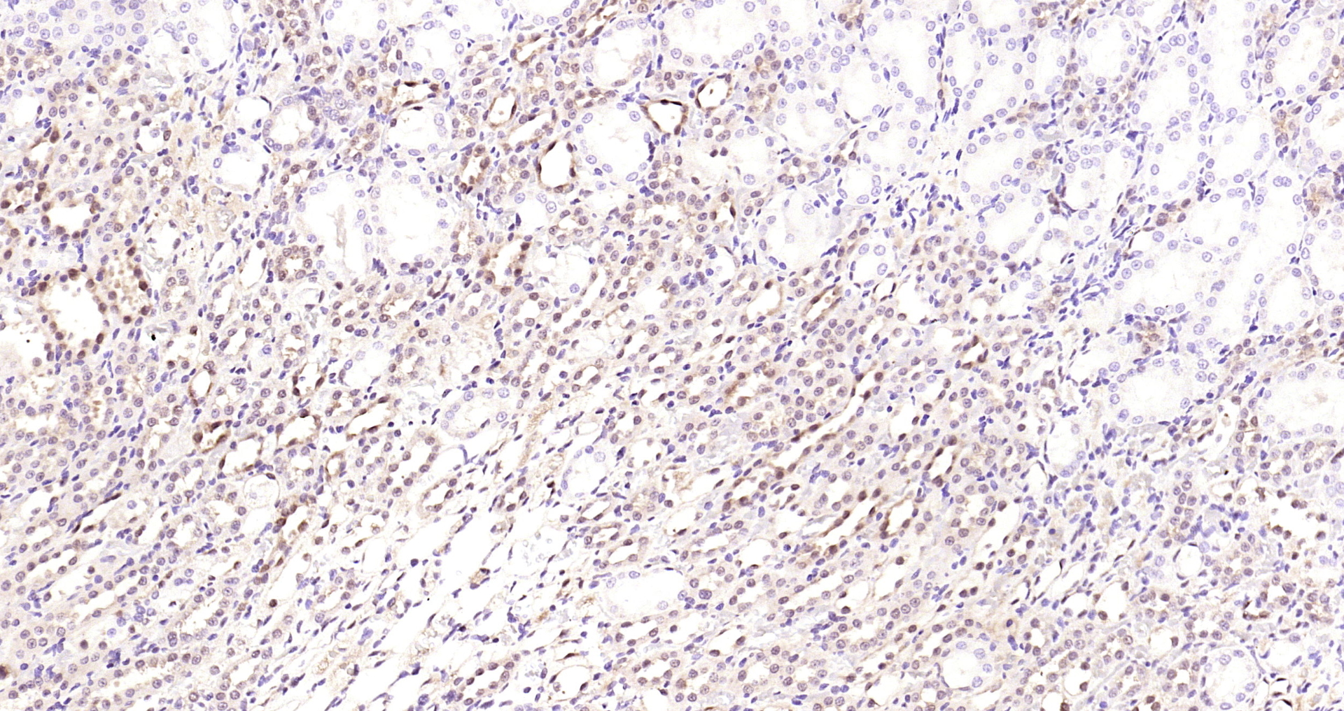 Paraformaldehyde-fixed, paraffin embedded Rat kidney; Antigen retrieval by boiling in sodium citrate buffer (pH6.0) for 15min; Block endogenous peroxidase by 3% hydrogen peroxide for 20 minutes; Blocking buffer (normal goat serum) at 37°C for 30min; Antibody incubation with STAT3 (3F5) Monoclonal Antibody, Unconjugated (bsm-33218M) at 1:2000 overnight at 4°C, DAB staining.