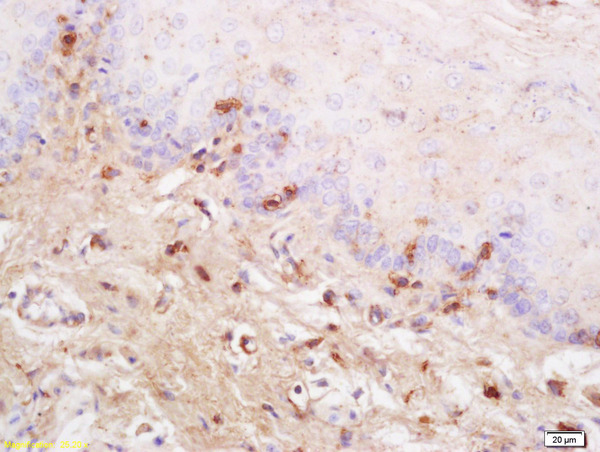 Formalin-fixed and paraffin embedded rat tongue labeled with Anti SynCAM/TSLC1 Polyclonal Antibody, Unconjugated (bs-6026R) at 1:200 followed by conjugation to the secondary antibody and DAB staining Formalin-fixed and paraffin embedded rat tongue labeled with Anti SynCAM/TSLC1 Polyclonal Antibody, Unconjugated (bs-6026R) at 1:200 followed by conjugation to the secondary antibody and DAB staining