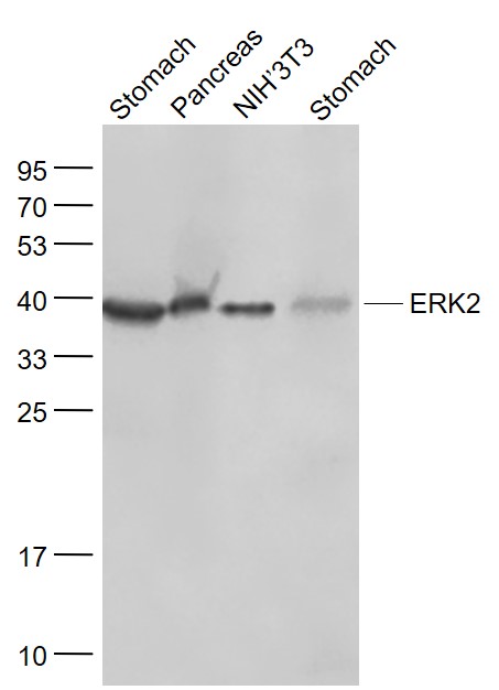 Lane 1: Mouse Stomach lysates; Lane 2: Mouse Pancreas lysates; Lane 3: Mouse NIH/3T3 cell lysates; Lane 4: Rat Stomach lysates probed with ERK2 monoclonal Antibody, Unconjugated (bsm-52068R) at 1:1000 dilution and 4˚C overnight incubation. Followed by conjugated secondary antibody incubation at 1:20000 for 60 min at 37˚C.