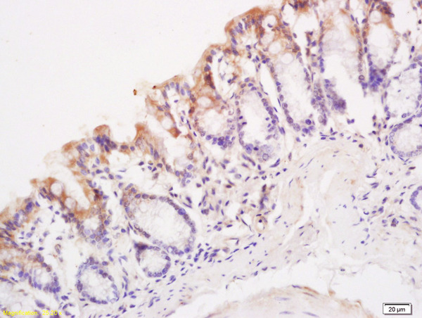 Formalin-fixed and paraffin embedded mouse intestine labeled with Anti SynCAM/TSLC1 Polyclonal Antibody, Unconjugated (bs-6026R) at 1:200 followed by conjugation to the secondary antibody and DAB staining