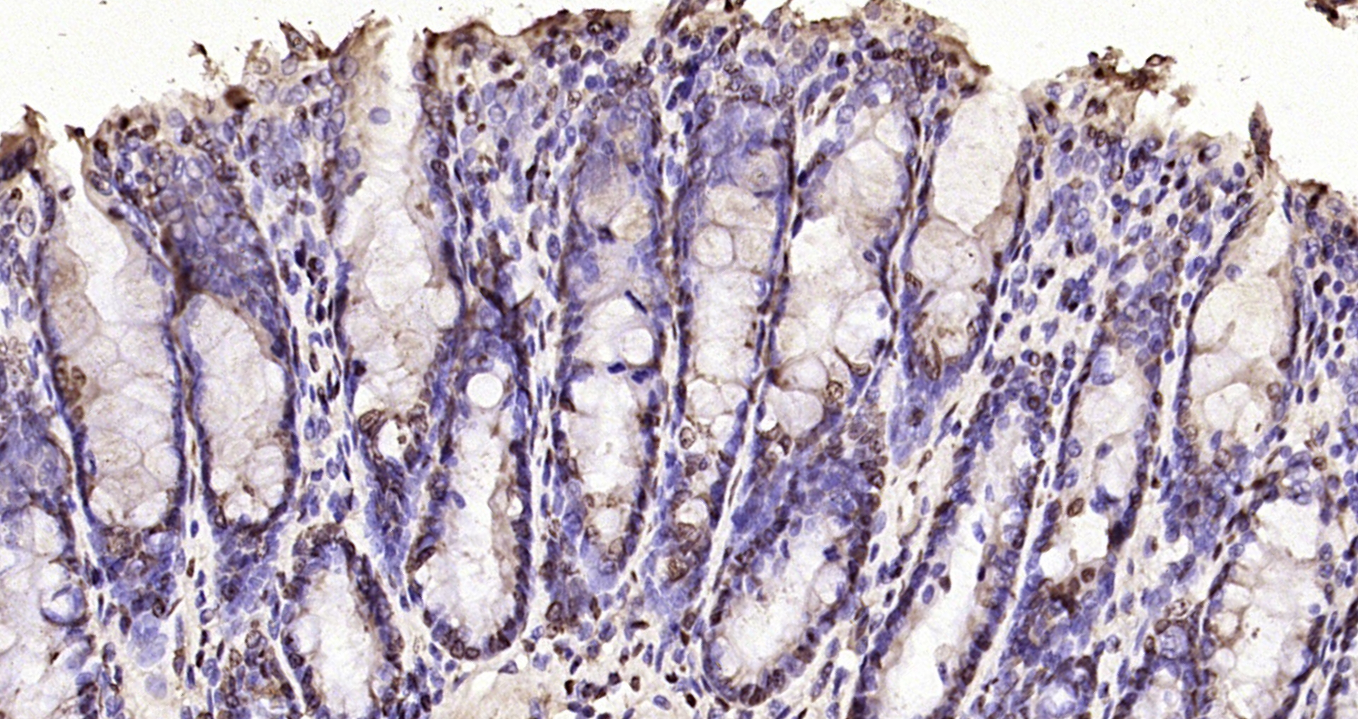 Paraformaldehyde-fixed, paraffin embedded Rat colon; Antigen retrieval by boiling in sodium citrate buffer (pH6.0) for 15min; Block endogenous peroxidase by 3% hydrogen peroxide for 20 minutes; Blocking buffer (normal goat serum) at 37°C for 30min; Antibody incubation with Histone H3 Polyclonal Antibody, Unconjugated (bs-0349R) at 1:200 overnight at 4°C, DAB staining.