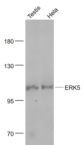 Lane 1: Mouse Testis lysates; Lane 2: Human Hela cell lysates probed with ERK5 monoclonal Antibody, Unconjugated (bsm-52069R) at 1:1000 dilution and 4˚C overnight incubation. Followed by conjugated secondary antibody incubation at 1:20000 for 60 min at 37˚C.