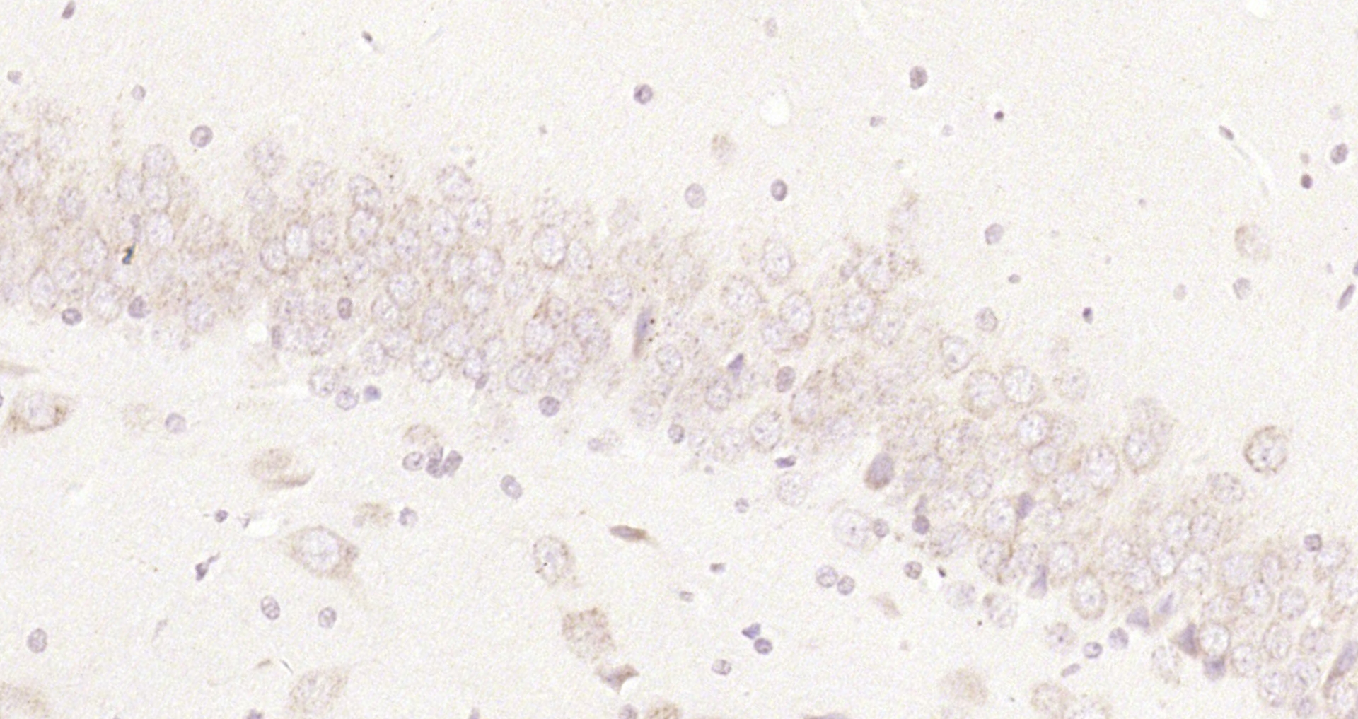 Paraformaldehyde-fixed, paraffin embedded Rat brain; Antigen retrieval by boiling in sodium citrate buffer (pH6.0) for 15min; Block endogenous peroxidase by 3% hydrogen peroxide for 20 minutes; Blocking buffer (normal goat serum) at 37°C for 30min; Antibody incubation with CDK4 Polyclonal Antibody, Unconjugated (bs-0633R) at 1:200 overnight at 4°C, DAB staining.