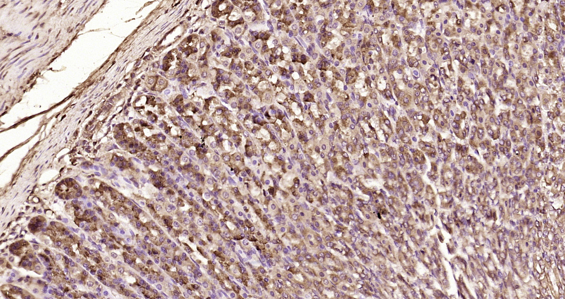 Paraformaldehyde-fixed, paraffin embedded Rat stomach; Antigen retrieval by boiling in sodium citrate buffer (pH6.0) for 15min; Block endogenous peroxidase by 3% hydrogen peroxide for 20 minutes; Blocking buffer (normal goat serum) at 37°C for 30min; Antibody incubation with KGF Polyclonal Antibody, Unconjugated (bs-0734R) at 1:200 overnight at 4°C, DAB staining. Paraformaldehyde-fixed, paraffin embedded Rat stomach; Antigen retrieval by boiling in sodium citrate buffer (pH6.0) for 15min; Block endogenous peroxidase by 3% hydrogen peroxide for 20 minutes; Blocking buffer (normal goat serum) at 37°C for 30min; Antibody incubation with KGF Polyclonal Antibody, Unconjugated (bs-0734R) at 1:200 overnight at 4°C, DAB staining.