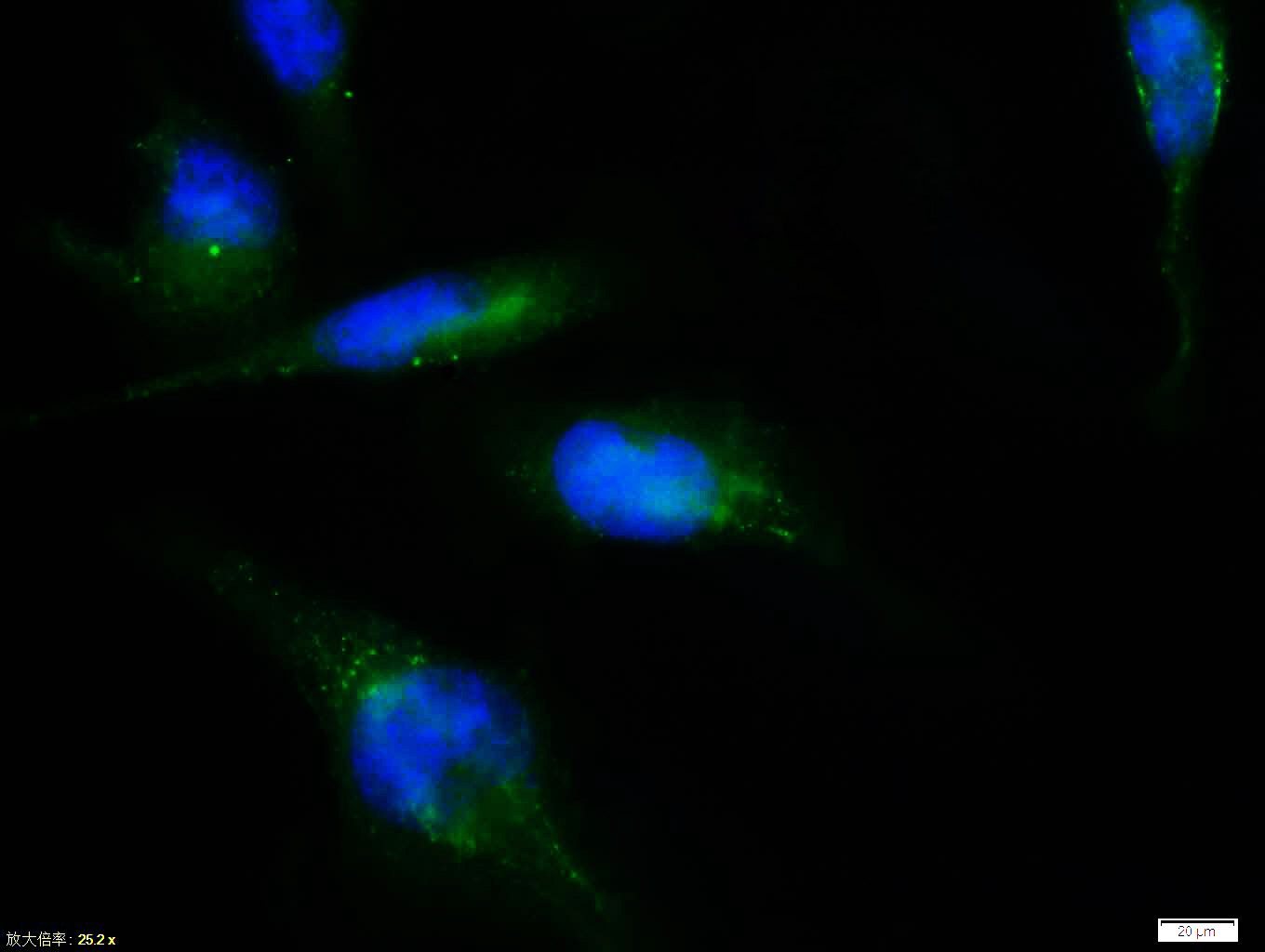 Tissue/cell:U-251 cell; 4% Paraformaldehyde-fixed; Triton X-100 at room temperature for 20 min; Blocking buffer (normal goat serum, C-0005) at 37°C for 20 min; Antibody incubation with (Nestin) polyclonal Antibody, Unconjugated (bs-0008R) 1:100, 90 minutes at 37°C; followed by a FITC conjugated Goat Anti-Rabbit IgG antibody at 37°C for 90 minutes, DAPI (blue, C02-04002) was used to stain the cell nuclei.