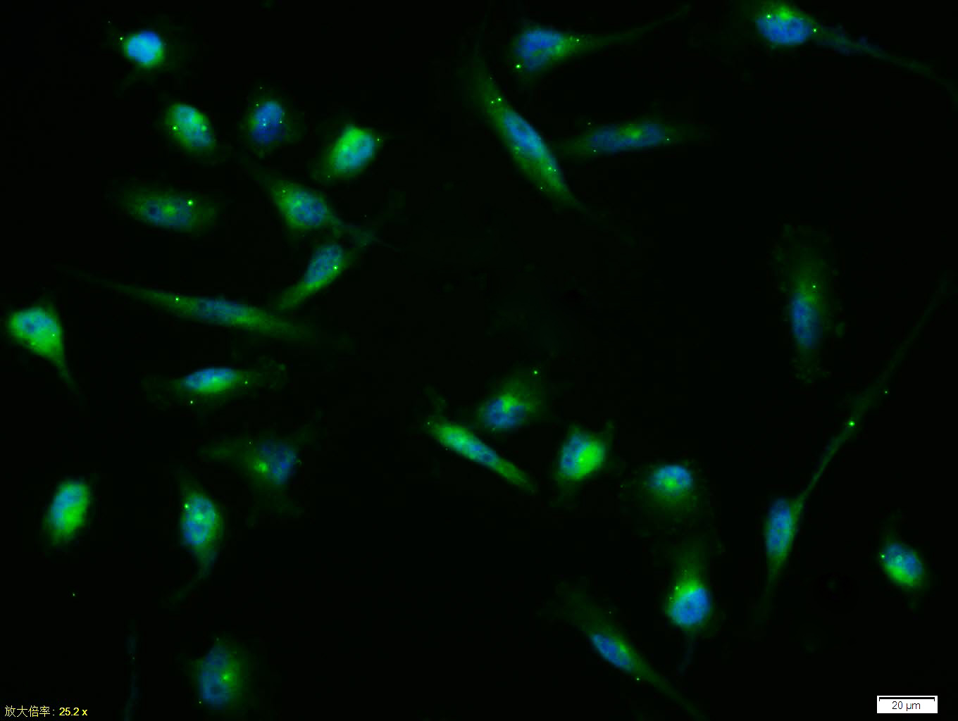 Tissue/cell:U-251 cell; 4% Paraformaldehyde-fixed; Triton X-100 at room temperature for 20 min; Blocking buffer (normal goat serum, C-0005) at 37°C for 20 min; Antibody incubation with (Connexin 43) polyclonal Antibody, Unconjugated (bs-0651R) 1:100, 90 minutes at 37°C; followed by a FITC conjugated Goat Anti-Rabbit IgG antibody at 37°C for 90 minutes, DAPI (blue, C02-04002) was used to stain the cell nuclei.