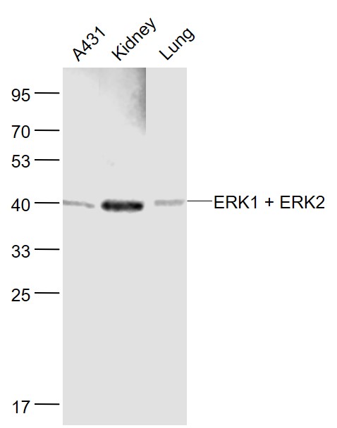 Lane 1: Human A431 cell lysates; Lane 2: Mouse Kidney lysates; Lane 3: Mouse Lung lysates probed withERK1 + ERK2 Polyclonal Antibody, Unconjugated (bs-0022R) at 1:1000 dilution and 4˚C overnight incubation. Followed by conjugated secondary antibody incubation at 1:20000 for 60 min at 37˚C.