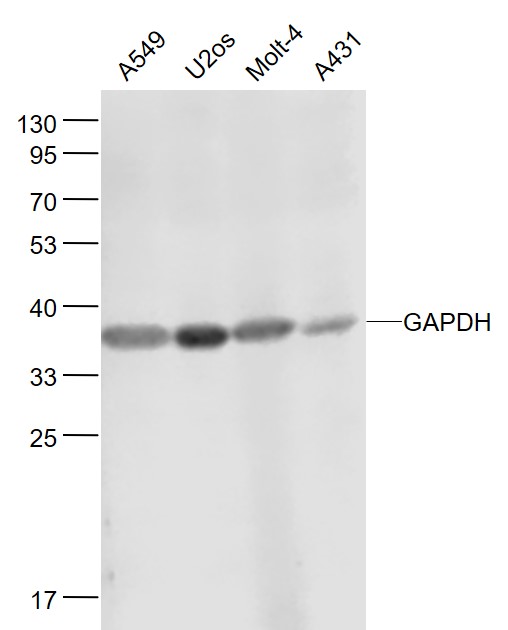 Lane 1: Huamn  A549 cell lysates; Lane 2:Huamn U-2OS\r\n cell lysates; Lane 3: Huamn MOLT-4 cell lysates; Lane 4:  Huamn A431 cell lysates probed with GAPDH Polyclonal Antibody, Unconjugated (bs-2188R) at 1:2000 dilution and 4˚C overnight incubation. Followed by conjugated secondary antibody incubation at 1:20000 for 60 min at 37˚C.