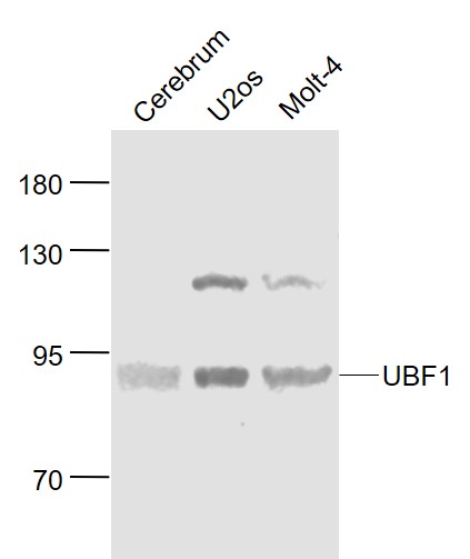 Lane 1: Mouse Cerebrum lysates; Lane 2: Human U-2OS_x000D_  cell lysates; Lane 3: Human MOLT-4 cell lysates probed with UBF1 Polyclonal Antibody, Unconjugated (bs-2362R) at 1:1000 dilution and 4˚C overnight incubation. Followed by conjugated secondary antibody incubation at 1:20000 for 60 min at 37˚C.