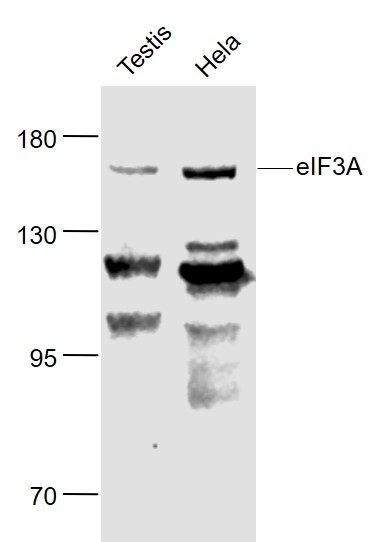 Lane 1: Mouse Testis lysates; Lane 2: Human Hela cell lysates probed with eIF3A Polyclonal Antibody, Unconjugated (bs-3840R) at 1:1000 dilution and 4˚C overnight incubation. Followed by conjugated secondary antibody incubation at 1:20000 for 60 min at 37˚C.