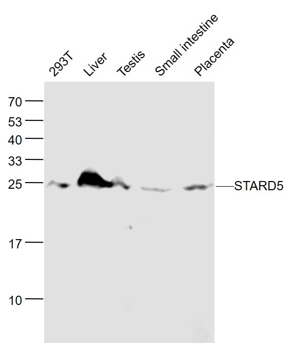 Lane 1: Human 293T cell lysates; Lane 2: Mouse Liver lysates; Lane 3: Mouse Testis lysates; Lane 4: Mouse Small intestine lysates; Lane 5: Mouse Placenta lysates probed with STARD5 Polyclonal Antibody, Unconjugated (bs-3919R) at 1:1000 dilution and 4˚C overnight incubation. Followed by conjugated secondary antibody incubation at 1:20000 for 60 min at 37˚C.