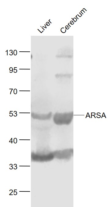 Lane 1: Mouse Liver lysates; Lane 2: Mouse Cerebrum lysates probed with ARSA Polyclonal Antibody, Unconjugated (bs-4006R) at 1:1000 dilution and 4˚C overnight incubation. Followed by conjugated secondary antibody incubation at 1:20000 for 60 min at 37˚C.