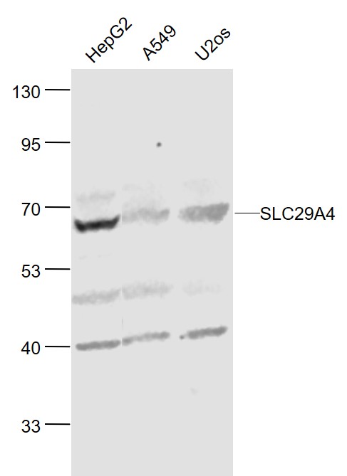 Lane 1: Human HepG2 cell lysates; Lane 2: Human A549 cell lysates; Lane 3: Human U-2OS cell lysates probed with SLC29A4 Polyclonal Antibody, Unconjugated (bs-4176R) at 1:1000 dilution and 4˚C overnight incubation. Followed by conjugated secondary antibody incubation at 1:20000 for 60 min at 37˚C. Lane 1: Human HepG2 cell lysates; Lane 2: Human A549 cell lysates; Lane 3: Human U-2OS cell lysates probed with SLC29A4 Polyclonal Antibody, Unconjugated (bs-4176R) at 1:1000 dilution and 4˚C overnight incubation. Followed by conjugated secondary antibody incubation at 1:20000 for 60 min at 37˚C.