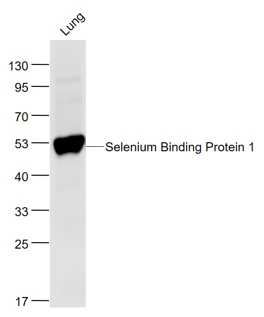Lane 1: Mouse Lung lysates probed with Selenium Polyclonal Antibody, Unconjugated (bs-4200R) at 1:1000 dilution and 4˚C overnight incubation. Followed by conjugated secondary antibody incubation at 1:20000 for 60 min at 37˚C. Lane 1: Mouse Lung lysates probed with Selenium Polyclonal Antibody, Unconjugated (bs-4200R) at 1:1000 dilution and 4˚C overnight incubation. Followed by conjugated secondary antibody incubation at 1:20000 for 60 min at 37˚C.
