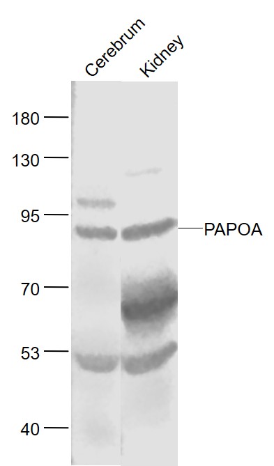 Lane 1: Mouse Cerebrum lysates; Lane 2: Mouse Kidney lysates probed with PAPOA Polyclonal Antibody, Unconjugated (bs-4966R) at 1:1000 dilution and 4˚C overnight incubation. Followed by conjugated secondary antibody incubation at 1:20000 for 60 min at 37˚C.