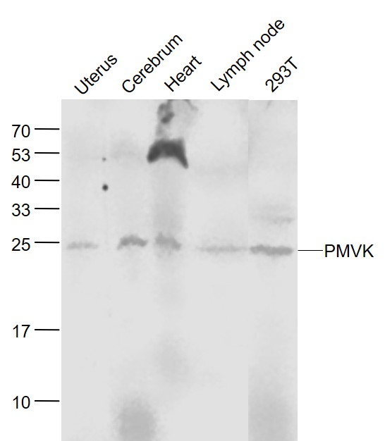 Lane 1: Mouse Uterus lysates; Lane 2: Mouse Cerebrum lysates; Lane 3: Mouse Heart lysates; Lane 4: Mouse Lymph node lysates; Lane 5: Human 293T cell lysates probed with PMVK Polyclonal Antibody, Unconjugated (bs-5371R) at 1:1000 dilution and 4˚C overnight incubation. Followed by conjugated secondary antibody incubation at 1:20000 for 60 min at 37˚C.