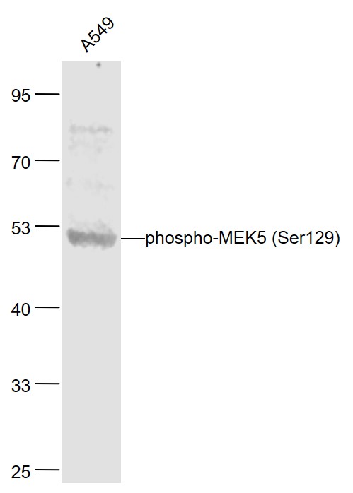 Lane 1: Human A549 cell lysates probed with MEK5 Polyclonal Antibody, Unconjugated (bs-5431R) at 1:1000 dilution and 4˚C overnight incubation. Followed by conjugated secondary antibody incubation at 1:20000 for 60 min at 37˚C