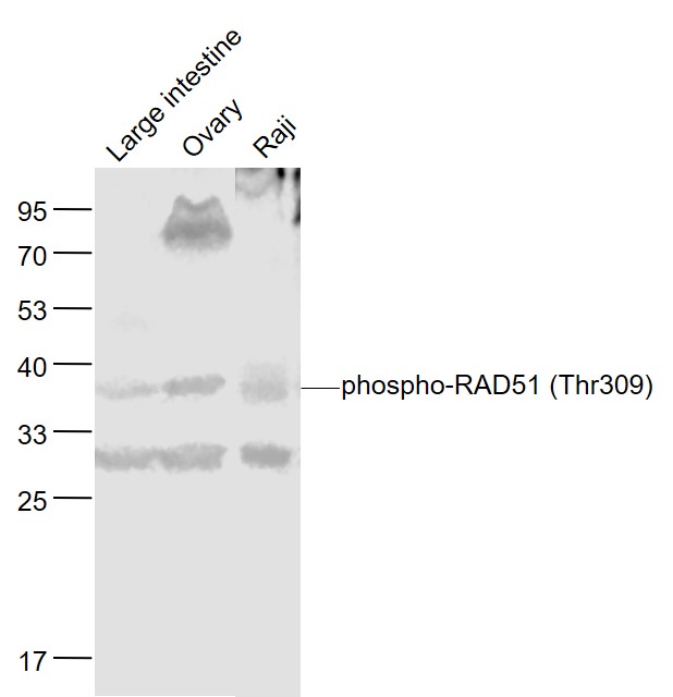 Lane 1: Mouse Large intestine lysates; Lane 2: Mouse Ovary lysates; Lane 3: Human Raji cell lysates probed with RAD51 Polyclonal Antibody, Unconjugated (bs-5677R) at 1:1000 dilution and 4˚C overnight incubation. Followed by conjugated secondary antibody incubation at 1:20000 for 60 min at 37˚C