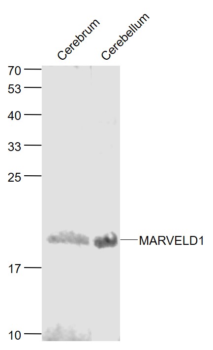 Lane 1: Mouse Cerebrum lysates; Lane 2: Mouse Cerebellum lysates probed with MARVELD1 Polyclonal Antibody, Unconjugated (bs-6548R) at 1:1000 dilution and 4˚C overnight incubation. Followed by conjugated secondary antibody incubation at 1:20000 for 60 min at 37˚C.