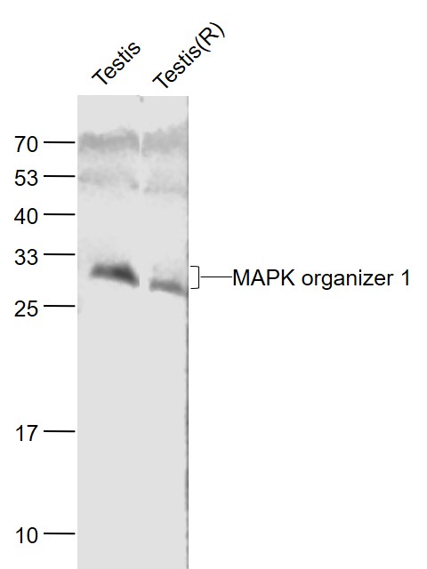 Lane 1: Mouse Testis lysates; Lane 2: Rat Testis lysates probed with MAPK organizer 1 Polyclonal Antibody, Unconjugated (bs-6722R) at 1:1000 dilution and 4˚C overnight incubation. Followed by conjugated secondary antibody incubation at 1:20000 for 60 min at 37˚