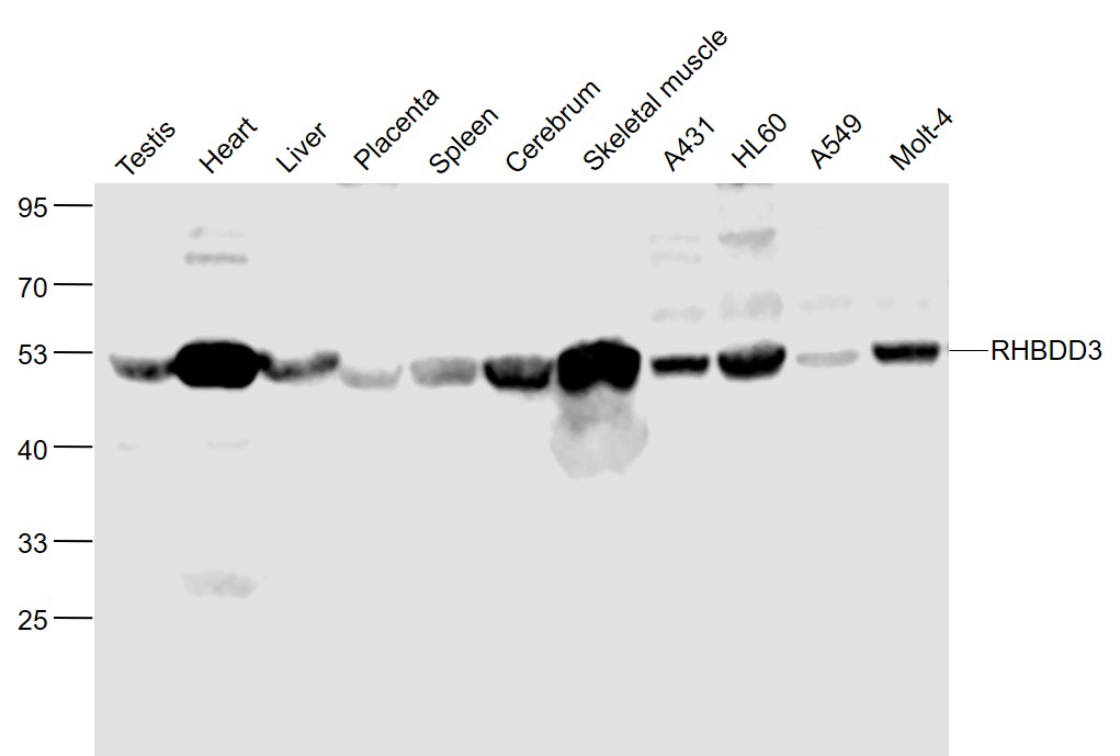 Lane 1: Mouse Testis lysates; Lane 2: Mouse Heart lysates; Lane 3: Mouse Liver lysates; Lane 4: Mouse Placenta lysates; Lane 5: Mouse Spleen lysates; Lane 6: Mouse Cerebrum lysates; Lane 7: Mouse Skeletal muscle lysates; Lane 8: Human A431 cell lysates; Lane 9: Human HL-60 cell lysates; Lane 10: Human A549 cell lysates; Lane 11: Human MOLT-4 cell lysates probed with RHBDD3 Polyclonal Antibody, Unconjugated (bs-7566R) at 1:1000 dilution and 4˚C overnight incubation. Followed by conjugated secondary antibody incubation at 1:20000 for 60 min at 37˚C.
