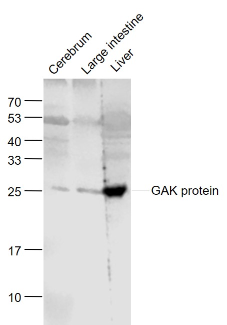 Lane 1: Mouse Cerebrum lysates; Lane 2: Mouse Large intestine lysates; Lane 3: Mouse Liver cell lysates probed with GAK protein Polyclonal Antibody, Unconjugated (bs-7912R) at 1:1000 dilution and 4˚C overnight incubation. Followed by conjugated secondary antibody incubation at 1:20000 for 60 min at 37˚C.