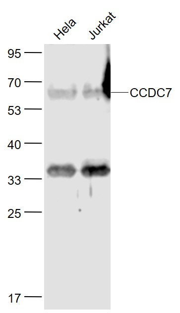 Lane 1: Human Hela cell lysates; Lane 2: Human Jurkat cell lysates probed with CCDC7 Polyclonal Antibody, Unconjugated (bs-7991R) at 1:1000 dilution and 4˚C overnight incubation. Followed by conjugated secondary antibody incubation at 1:20000 for 60 min at 37˚C. Lane 1: Human Hela cell lysates; Lane 2: Human Jurkat cell lysates probed with CCDC7 Polyclonal Antibody, Unconjugated (bs-7991R) at 1:1000 dilution and 4˚C overnight incubation. Followed by conjugated secondary antibody incubation at 1:20000 for 60 min at 37˚C.