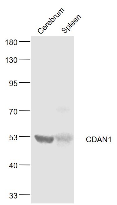 Lane 1: Mouse Cerebrum lysates; Lane 2: Mouse Spleen lysates probed with CDAN1 Polyclonal Antibody, Unconjugated (bs-7994R) at 1:1000 dilution and 4˚C overnight incubation. Followed by conjugated secondary antibody incubation at 1:20000 for 60 min at 37˚C.