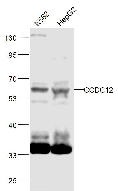 Lane 1: Human K562 cell lysates; Lane 2: Human HepG2_x000D_ cell lysates probed with CCDC12 Polyclonal Antibody, Unconjugated (bs-8104R) at 1:1000 dilution and 4˚C overnight incubation. Followed by conjugated secondary antibody incubation at 1:20000 for 60 min at 37˚C. Lane 1: Human K562 cell lysates; Lane 2: Human HepG2_x000D_ cell lysates probed with CCDC12 Polyclonal Antibody, Unconjugated (bs-8104R) at 1:1000 dilution and 4˚C overnight incubation. Followed by conjugated secondary antibody incubation at 1:20000 for 60 min at 37˚C.