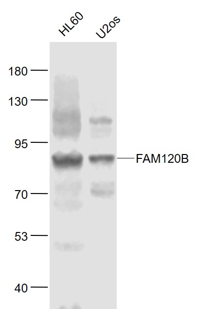 Lane 1: Human HL-60 cell lysates; Lane 2: Human U-2OS cell lysates probed with FAM120B Polyclonal Antibody, Unconjugated (bs-8195R) at 1:1000 dilution and 4˚C overnight incubation. Followed by conjugated secondary antibody incubation at 1:20000 for 60 min at 37˚C.