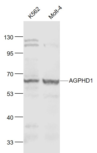 Lane 1: Human K562 cell lysates; Lane 2: Human MOLT-4 cell lysates probed with AGPHD Polyclonal Antibody, Unconjugated (bs-8457R) at 1:1000 dilution and 4˚C overnight incubation. Followed by conjugated secondary antibody incubation at 1:20000 for 60 min at 37˚C.