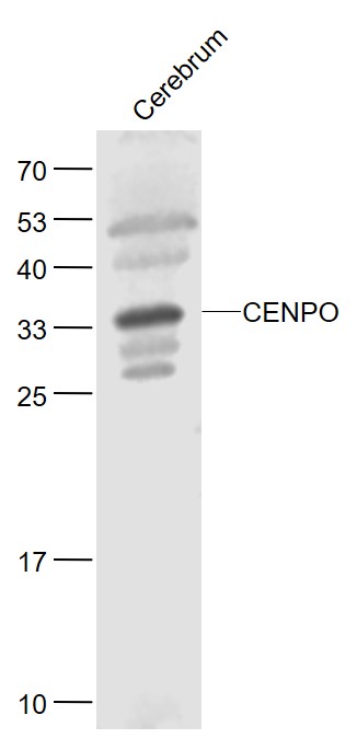 Lane 1: Mouse Cerebrum lysates probed with CENPO Polyclonal Antibody, Unconjugated (bs-9305R) at 1:1000 dilution and 4˚C overnight incubation. Followed by conjugated secondary antibody incubation at 1:20000 for 60 min at 37˚C.