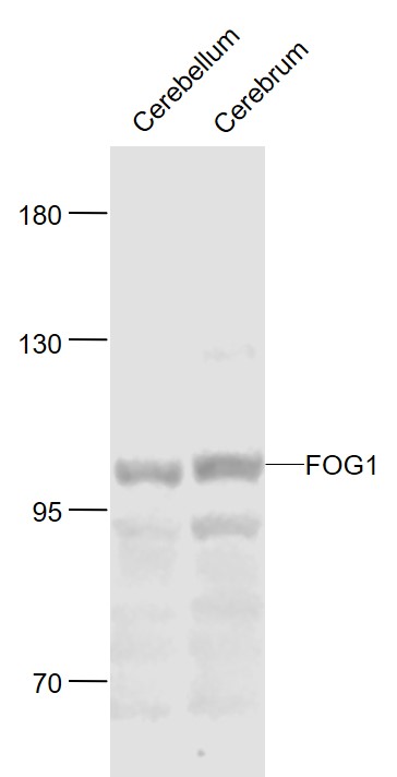 Lane 1: Mouse Cerebrum cell lysates; Lane 2: Mouse Cerebrum lysates probed with FOG1 Polyclonal Antibody, Unconjugated (bs-9451R) at 1:1000 dilution and 4˚C overnight incubation. Followed by conjugated secondary antibody incubation at 1:20000 for 60 min at 37˚C.