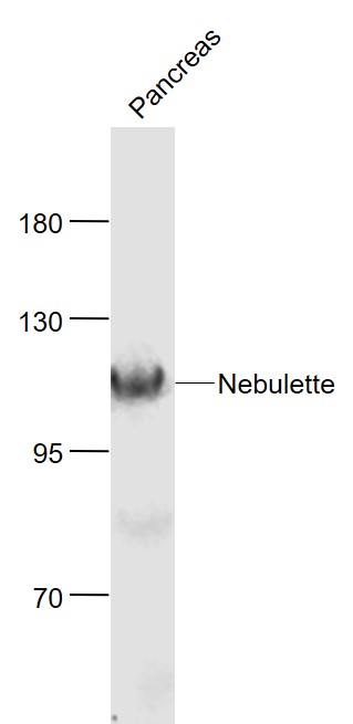 Lane 1: Mouse Pancreas lysates probed with Nebulette Polyclonal Antibody, Unconjugated (bs-9468R) at 1:1000 dilution and 4˚C overnight incubation. Followed by conjugated secondary antibody incubation at 1:20000 for 60 min at 37˚C. Lane 1: Mouse Pancreas lysates probed with Nebulette Polyclonal Antibody, Unconjugated (bs-9468R) at 1:1000 dilution and 4˚C overnight incubation. Followed by conjugated secondary antibody incubation at 1:20000 for 60 min at 37˚C.