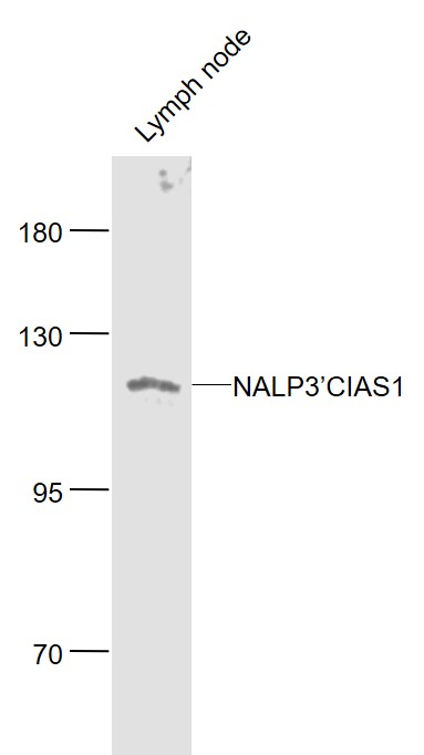 Lane 1: Mouse Lymph node lysates probed with Cryopyrin Polyclonal Antibody, Unconjugated (bs-10021R) at 1:1000 dilution and 4˚C overnight incubation. Followed by conjugated secondary antibody incubation at 1:20000 for 60 min at 37˚C.