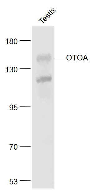 Lane 1: Mouse Testis lysates probed with OTOA/DFNB22 Polyclonal Antibody, Unconjugated (bs-11060R) at 1:1000 dilution and 4˚C overnight incubation. Followed by conjugated secondary antibody incubation at 1:20000 for 60 min at 37˚C.