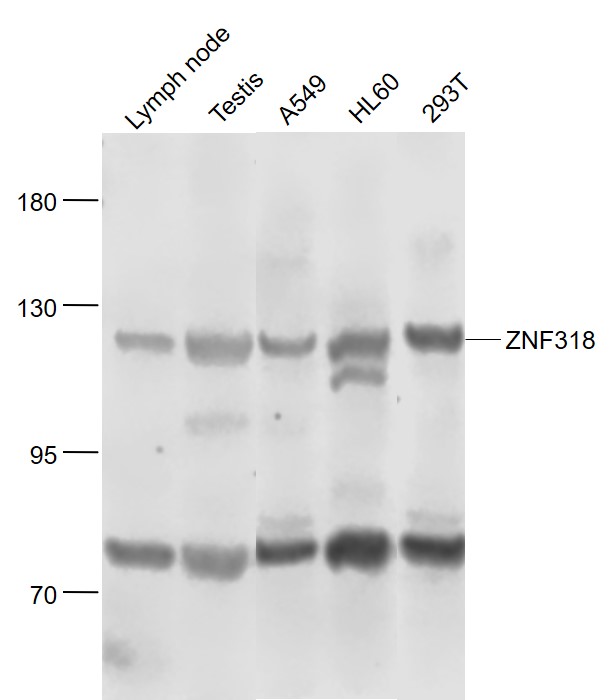Lane 1: Mouse Lymph node lysates; Lane 2: Mouse Testis lysates; Lane 3: Human A549 cell lysates; Lane 4: Human HL-60 cell lysates; Lane 5: Human 293T cell lysates probed with ZNF318 Polyclonal Antibody, Unconjugated (bs-11414R) at 1:1000 dilution and 4˚C overnight incubation. Followed by conjugated secondary antibody incubation at 1:20000 for 60 min at 37˚C.