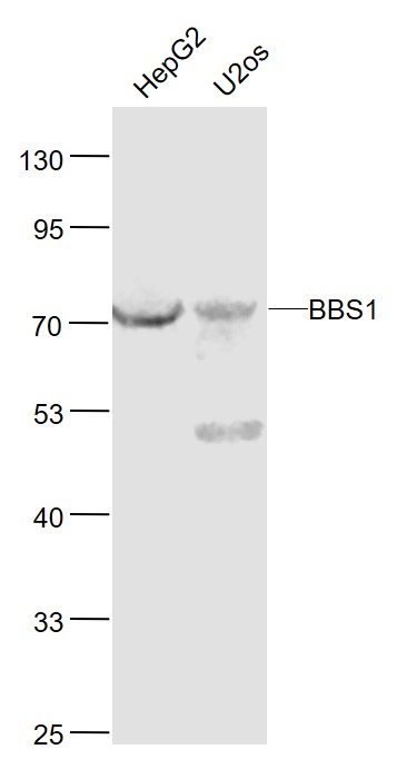 Lane 1: Human HepG2 cell lysates; Lane 2: Human U-2OS cell lysates probed with BBS1 Polyclonal Antibody, Unconjugated (bs-11507R) at 1:1000 dilution and 4˚C overnight incubation. Followed by conjugated secondary antibody incubation at 1:20000 for 60 min at 37˚C.